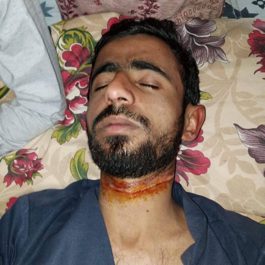 Mirpur: Youth Injured After Getting Entangled in Cable TV Wire